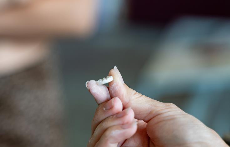 gravage bouton nacre