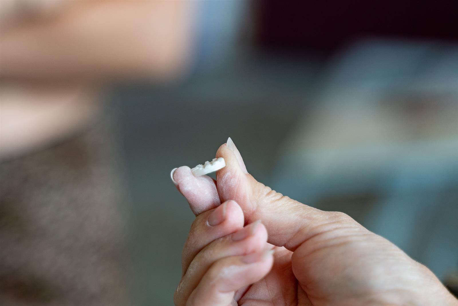 gravage bouton nacre